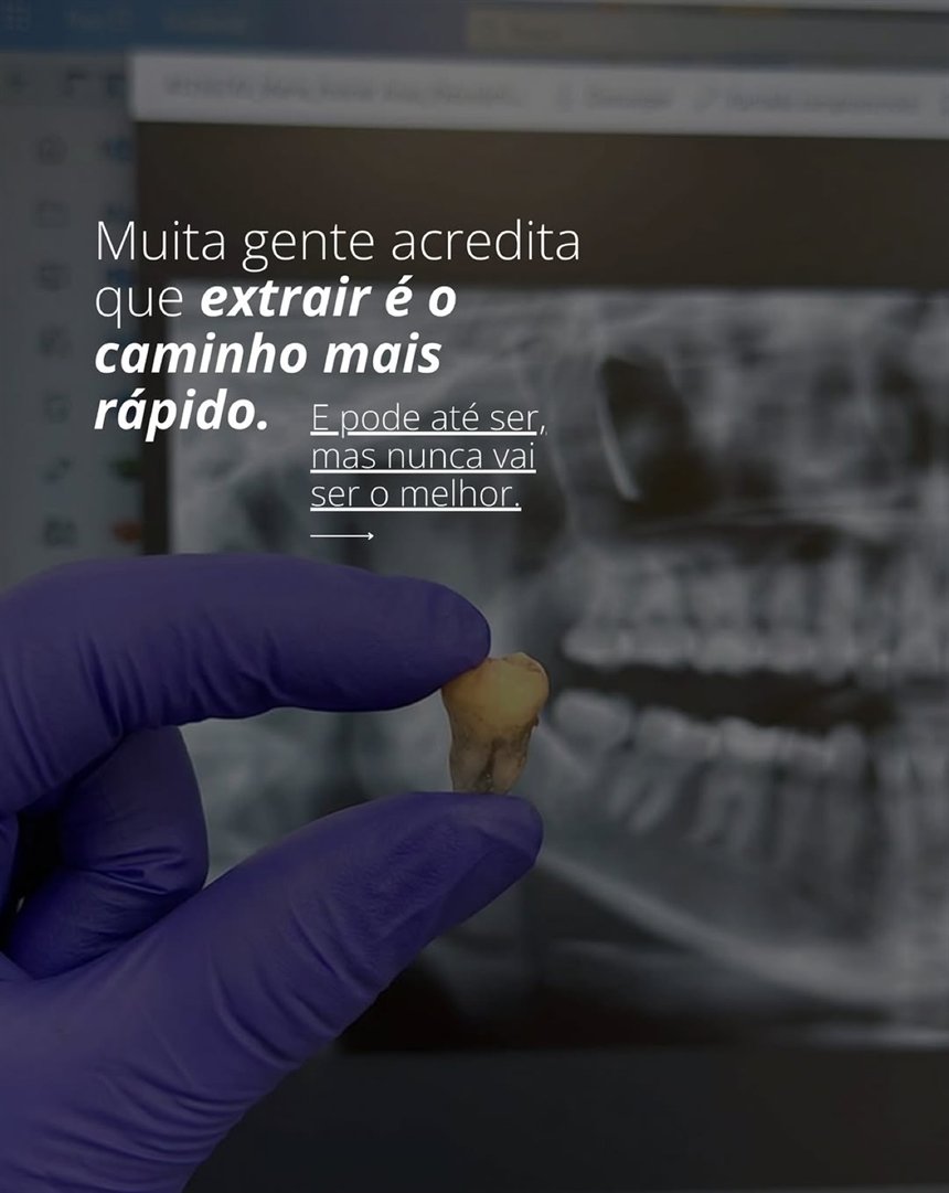 Post do Instagram sobre decidir o melhor caminho para um dente, com radiografia ao fundo